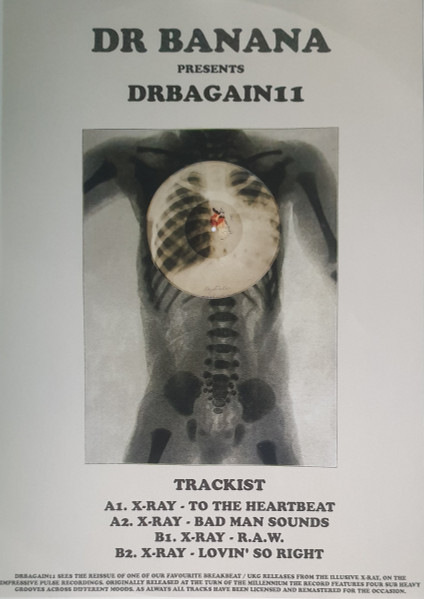X-Ray - DRBAGAIN11 | Dr Banana (DRBAGAIN11) - 2