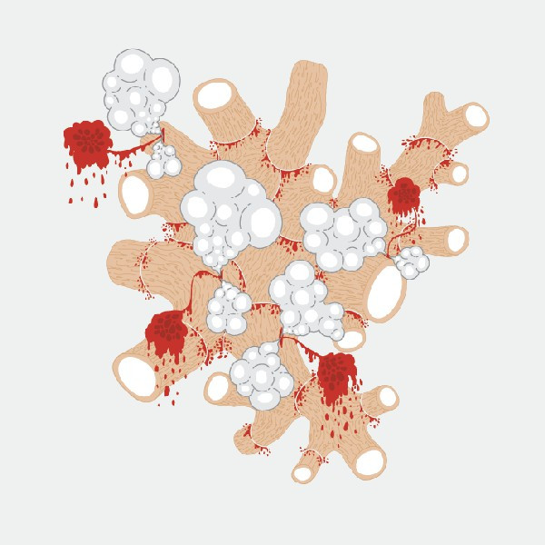 Saxon Shore - The Exquisite Death Of Saxon Shore | Burnt Toast Vinyl (btv070) - main