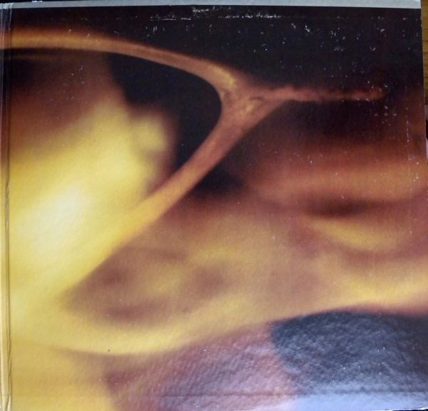 Wishbone Ash - Wishbone Ash | Decca (DL 75249) - 3