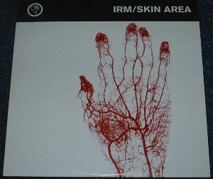 IRM / Skin Area - IRM / Skin Area | Segerhuva (SEGER 5) - 2