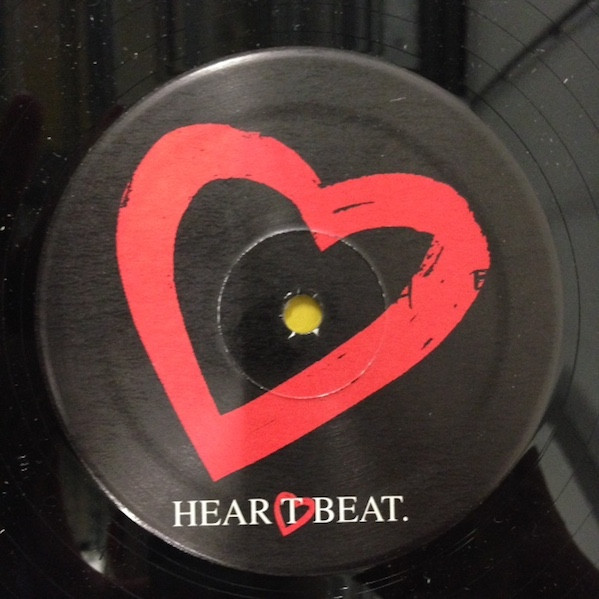 Uncle Sally - It's So Easy | Heartbeat (HB 084) - main