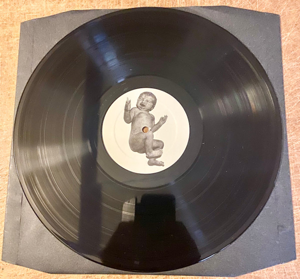 Preggy Peggy & The Lazy Babymakers - Get An Ace Case Of The Measles | Ultra Eczema (Ultra Eczema 63) - 4