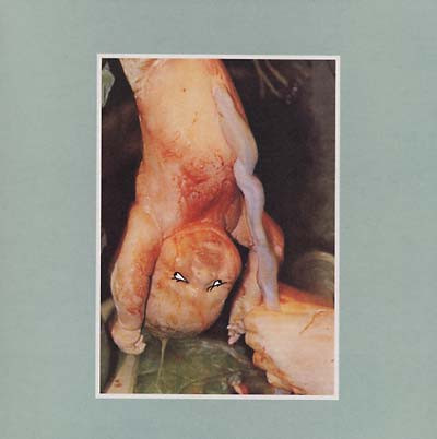 Preggy Peggy & The Lazy Babymakers - Get An Ace Case Of The Measles | Ultra Eczema (Ultra Eczema 63) - main
