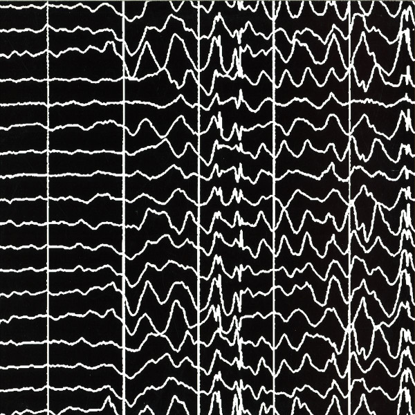DJ Matuss - Seizure No. 6 | Absence Seizure (AS006)